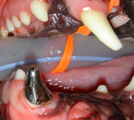 Prosthodontics Metal Canine Crown