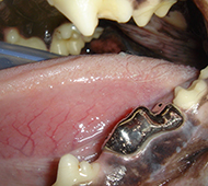  Molar Crown