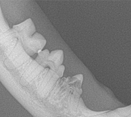 Tooth Resorption Abnormal Image