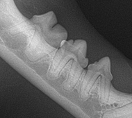 Tooth Resorption Normal Image